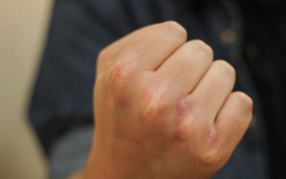 Бил камнем по голове: в Днепре мужчина напал на кондуктора трамвая