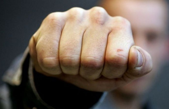 ЧП под Сумами: неизвестные жестоко избили экс-чиновника