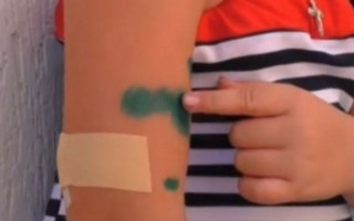 Повреждены лицо и руки: собака напала на ребенка под Луцком