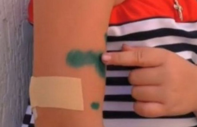 Повреждены лицо и руки: собака напала на ребенка под Луцком