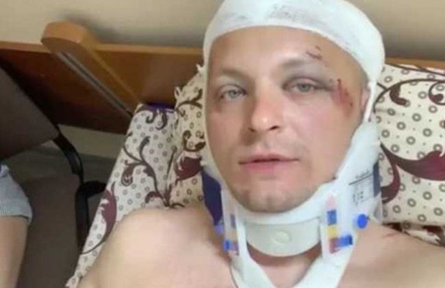 Жорстоке побиття екс-мера Конотопа:  у справі є подробиці