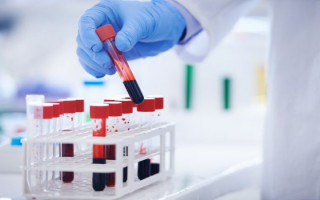 Стало известно, какая группа крови неуязвима для рака