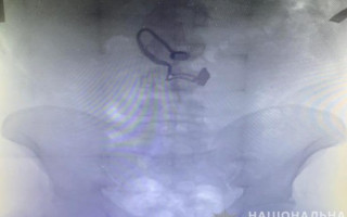 Зірвав із жінки ланцюжок і проковтнув: у Києві затримали грабіжника