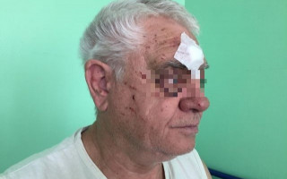 Напад на пенсіонера: поліцейський не захотів поступатися місцем