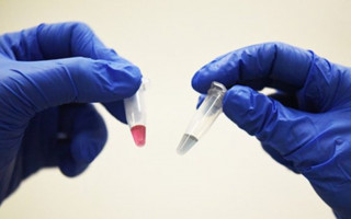 Симптом, який передує раку: нове дослідження канадських вчених