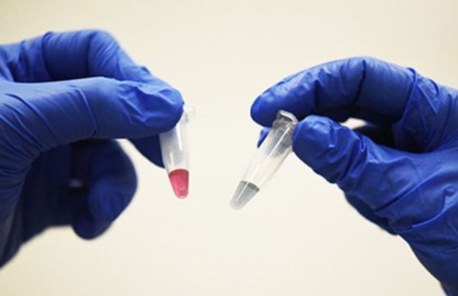 Симптом, який передує раку: нове дослідження канадських вчених