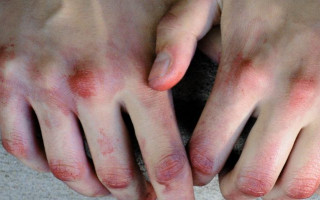 Пробили голову: в Киеве полицейских избили прямо в отделении