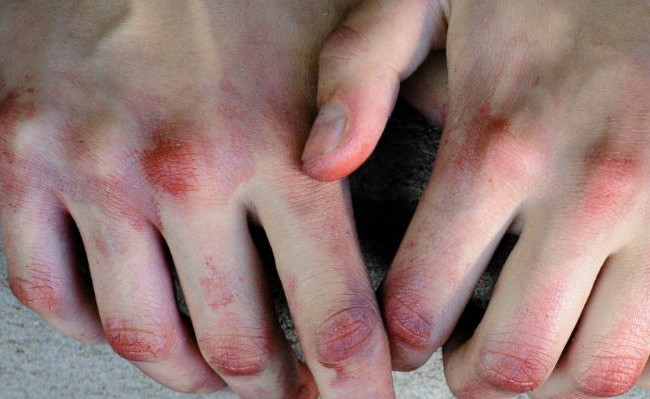 Пробили голову: в Киеве полицейских избили прямо в отделении