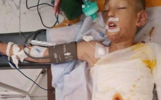 В Днепре дети подожгли сверстника: известно, в каком состоянии пострадавший