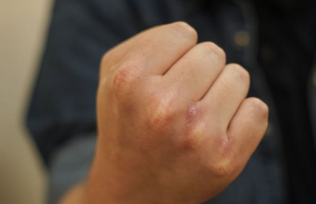 Жорстоко побив рідну матір: суд покарав горе-сина