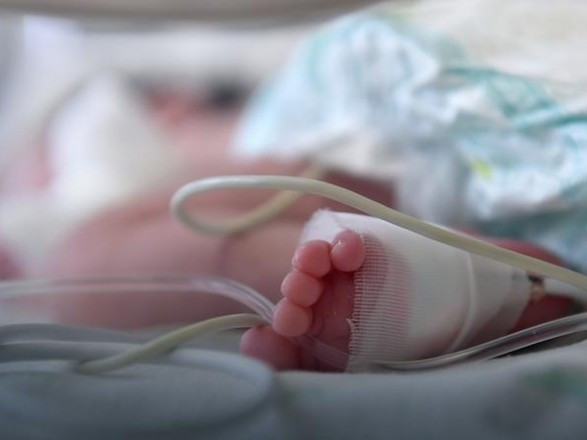 У Харкові горе-мати побила немовля до смерті: у дитини розвинувся набряк мозку