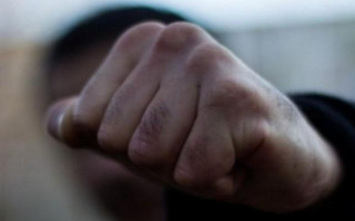 Под Одессой подростки жестоко избили прохожего