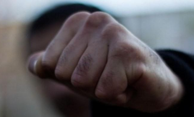 Под Одессой подростки жестоко избили прохожего