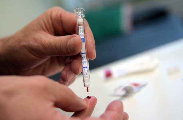 Киевлян приглашают бесплатно пройти тест на ВИЧ: адреса