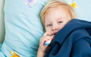 Украина в первой пятерке стран по заболеваемости корью