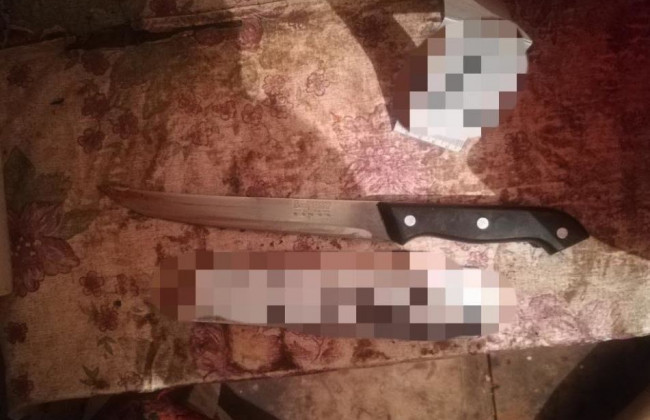 Заподозрила в измене: под Киевом девушка ударила своего парня ножом в сердце