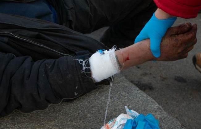 Били арматурой: в Днепре подростки напали на бездомных