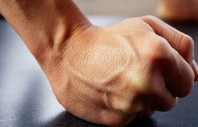 Проломил голову: под Киевом неадекват нападал на людей