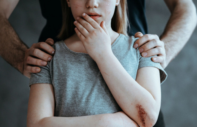 В Виннице отчим изнасиловал 6-летнюю девочку