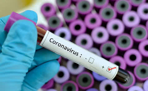 Украинцы скоро смогут пройти тест на коронавирус: что известно