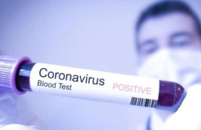 Эксперт рассказал, когда создадут вакцину от коронавируса