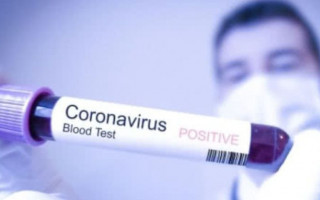 Эксперт рассказал, когда создадут вакцину от коронавируса