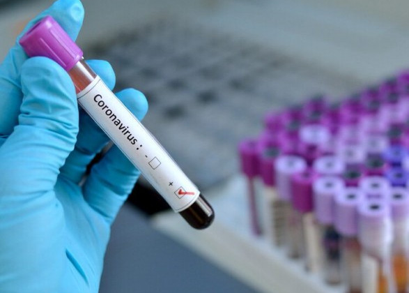 В Україні перевіряють підозри на коронавірус — Віктор Ляшко