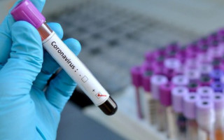 В Україні перевіряють підозри на коронавірус — Віктор Ляшко