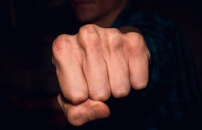 В киевской маршрутке мужчина разбил лицо девушке