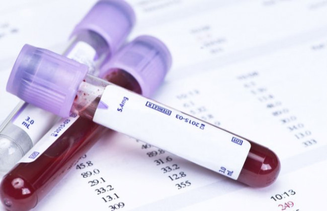 Допустимість висновків судово-медичних експертиз у кримінальному провадженні: ККС ВС виніс постанову