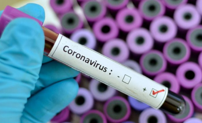 Два нові випадки коронавірусу в Україні: стали відомі подробиці