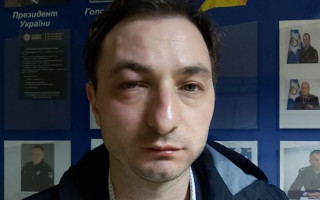 В Киеве жестоко избили известного врача: появилось видео