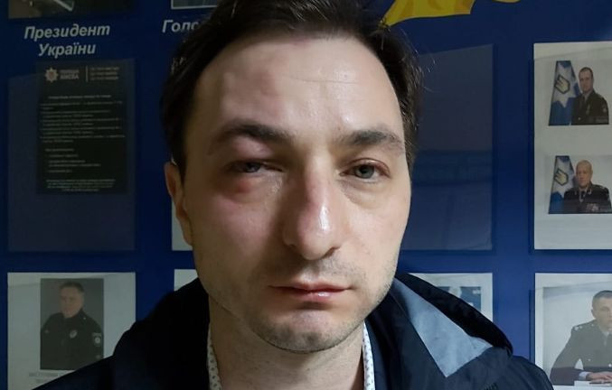 В Киеве жестоко избили известного врача: появилось видео