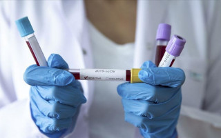 Украинский дипломат заразился коронавирусом