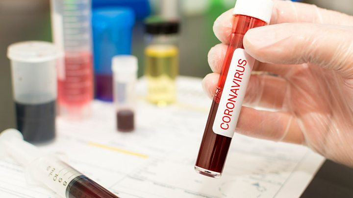 В Україні зафіксовані нові випадки коронавірусу