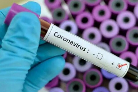 Раду не відвідував: нардеп заразився коронавірусом