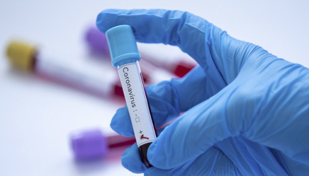 Пандемия коронавируса: в Украине сделали меньше всего в мире тестов на COVID-19