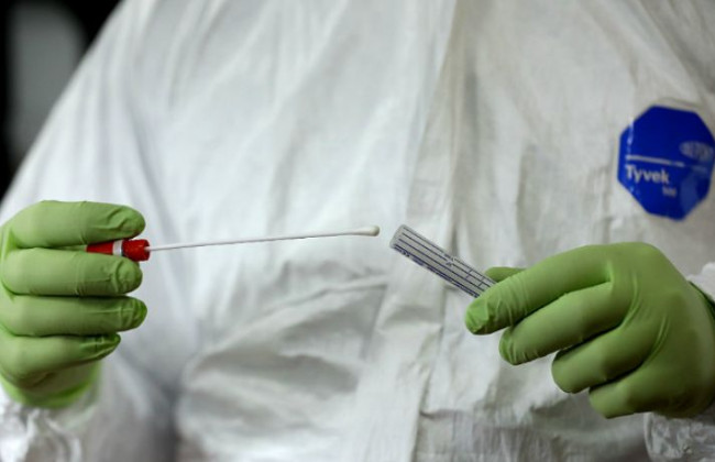 В Україні створили тест-систему для діагностики коронавірусу