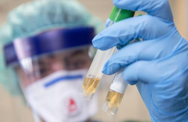 У Києві за добу додалася 20 випадків коронавірусу