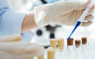 Боротьба з коронавірусом: в Україні зареєстровано вітчизняні виробники тест-систем