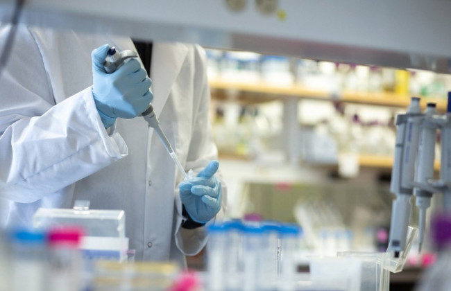 Українських мікробіологів, які розробили тест для виявлення COVID-19, відправили в неоплачувану відпустку