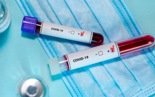 Кількість хворих на COVID-19 в Києві продовжує зростати