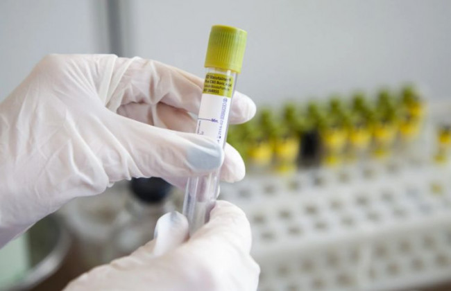 В Одессе обнаружено новые заражения коронавирусом