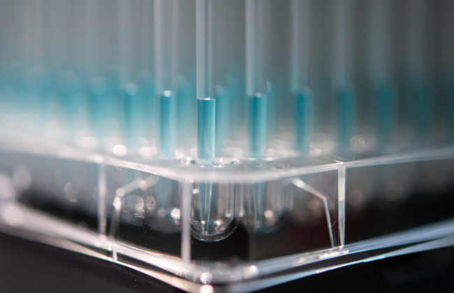 Жінки інфікуються частіше, а хворих серед молоді більше, ніж серед пенсіонерів: статистика коронавірусу в Україні