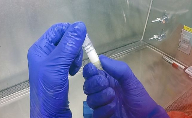 Миллионы смертей от коронавируса: в США спрогнозировали худший сценарий