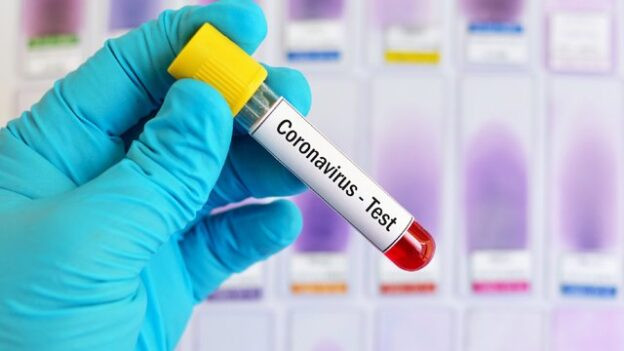 В ЗСУ зареєстрували перший випадок коронавірусу: на ізоляції 140 військових