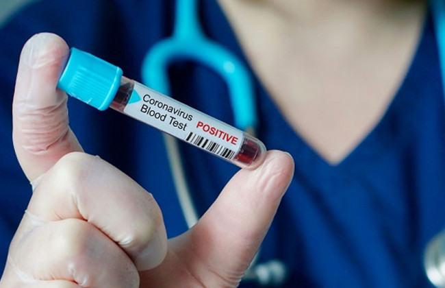 На Київщині зросла кількість випадків COVID-19: статистика по районах