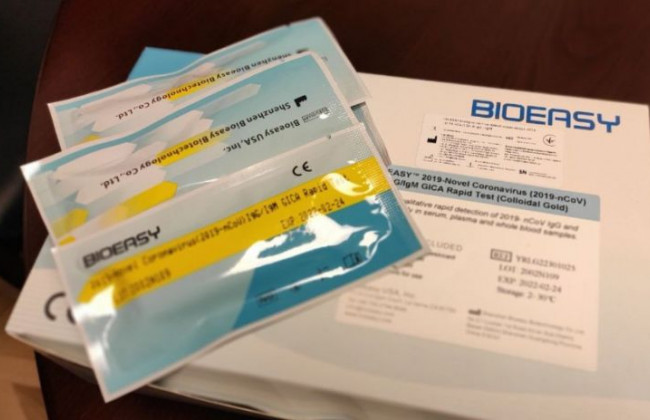 Стало відомо, яка область найбільше закупила тестів на коронавірус