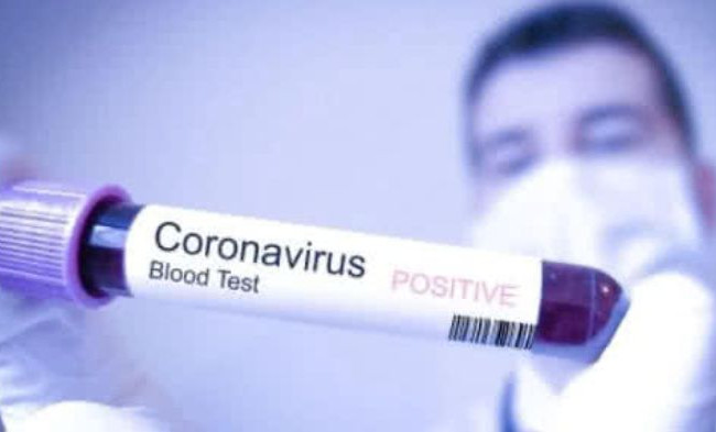 Занимался спортом: в Киеве от коронавируса умер молодой мужчина