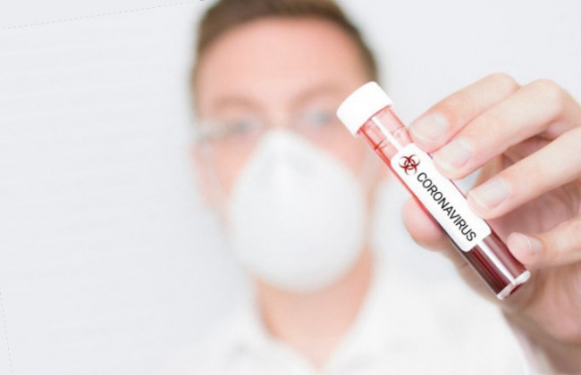 В Україні за добу від COVID-19 померли 12 людей: найчастіше жертвами стають жінки